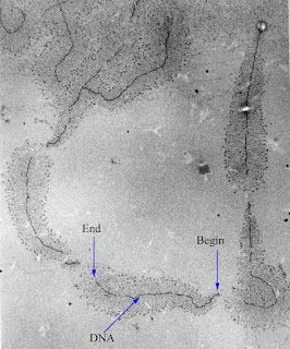 Ribosomal RNA geninin transkripsiyonunu gösteren elektron mikroskop resmi.
