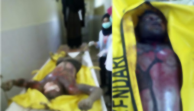 Akibat PCC Gratis, 66 Anak Di Kota Ini Kejang - Kejang dan Jadi Zombie Akibat PCC Gratis, 66 Anak Di Kota Ini Kejang - Kejang dan Jadi Zombie