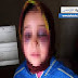 قضية تارودانت: نتائج الفحص بالأشعة الذي خضعت له التلميذة مريم قضية تارودانت: نتائج الفحص بالأشعة الذي خضعت له التلميذة مريم