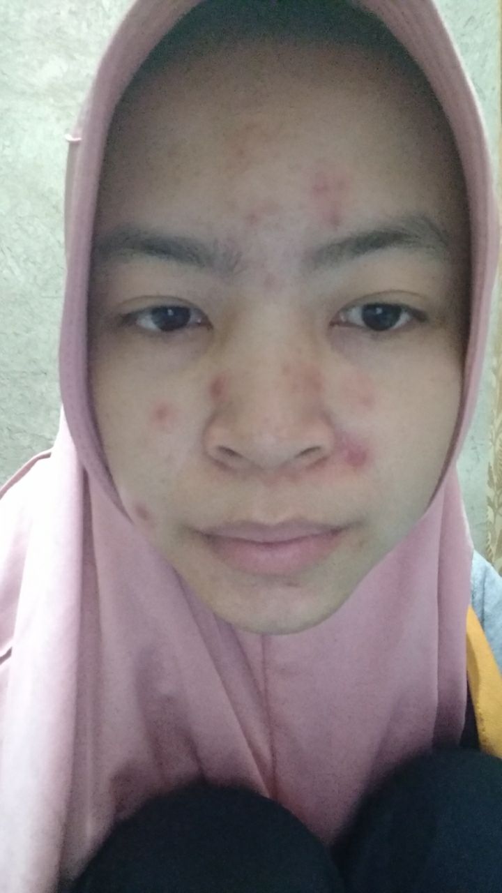 Pengalaman Awal Memakai Ms Glow Uninae