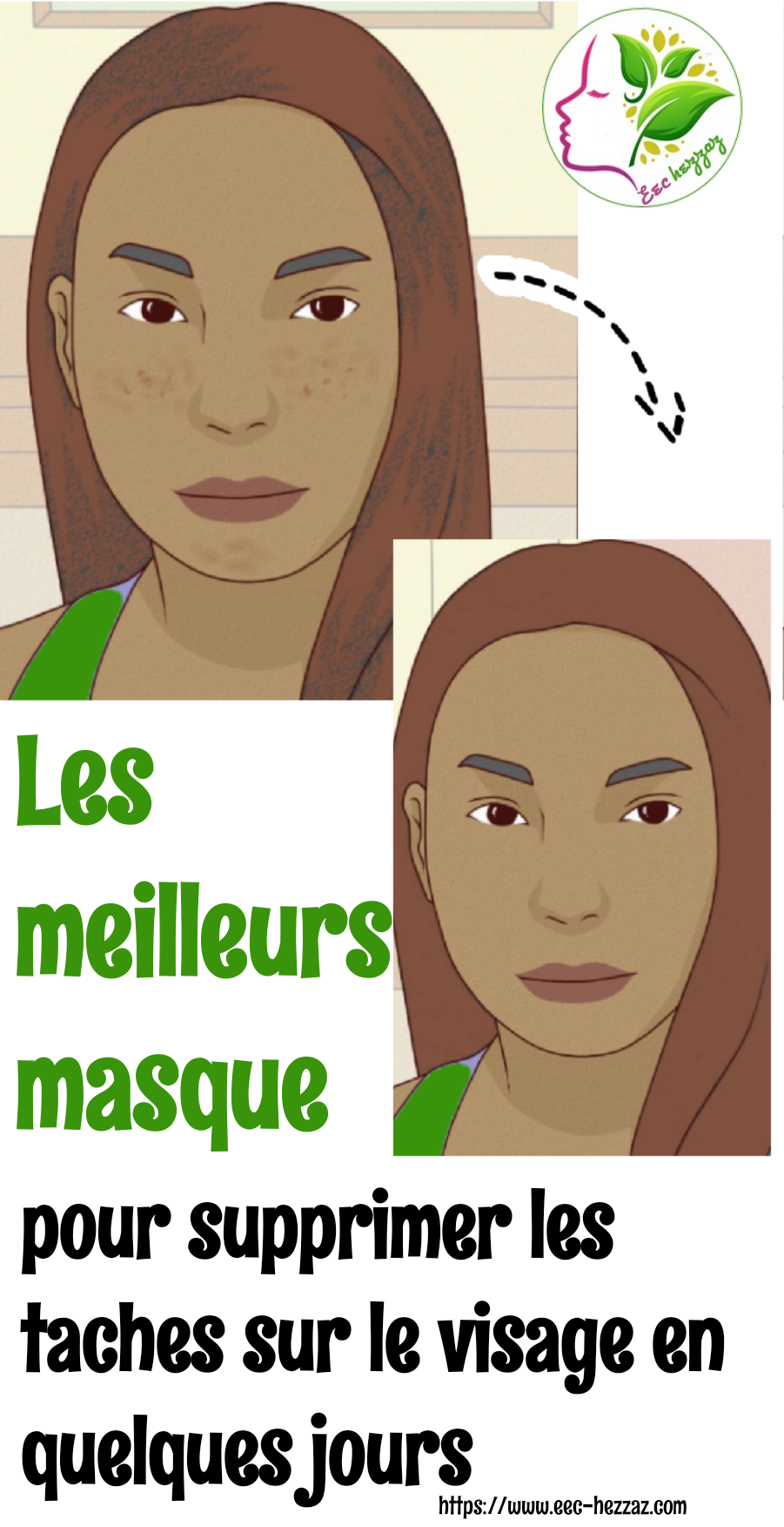 Les meilleurs masque pour supprimer les taches sur le visage en quelques joursLes meilleurs masque pour supprimer les taches sur le visage en quelques joursLes meilleurs masque pour supprimer les taches sur le visage en quelques jours