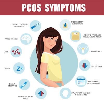 Simptom PCOS