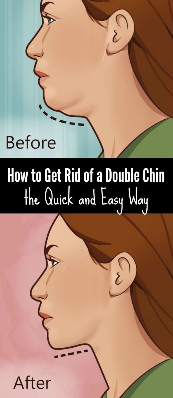 How To Get Rid Of A Double Chin The Quick And Easy Way Healthy Mom