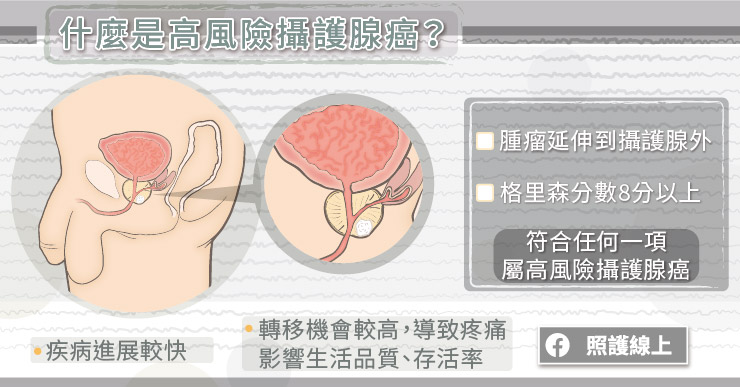 什麼是高風險攝護腺癌