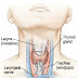 Risiko kerosakan urat peti suara kesan dari pembedahan tiroid.