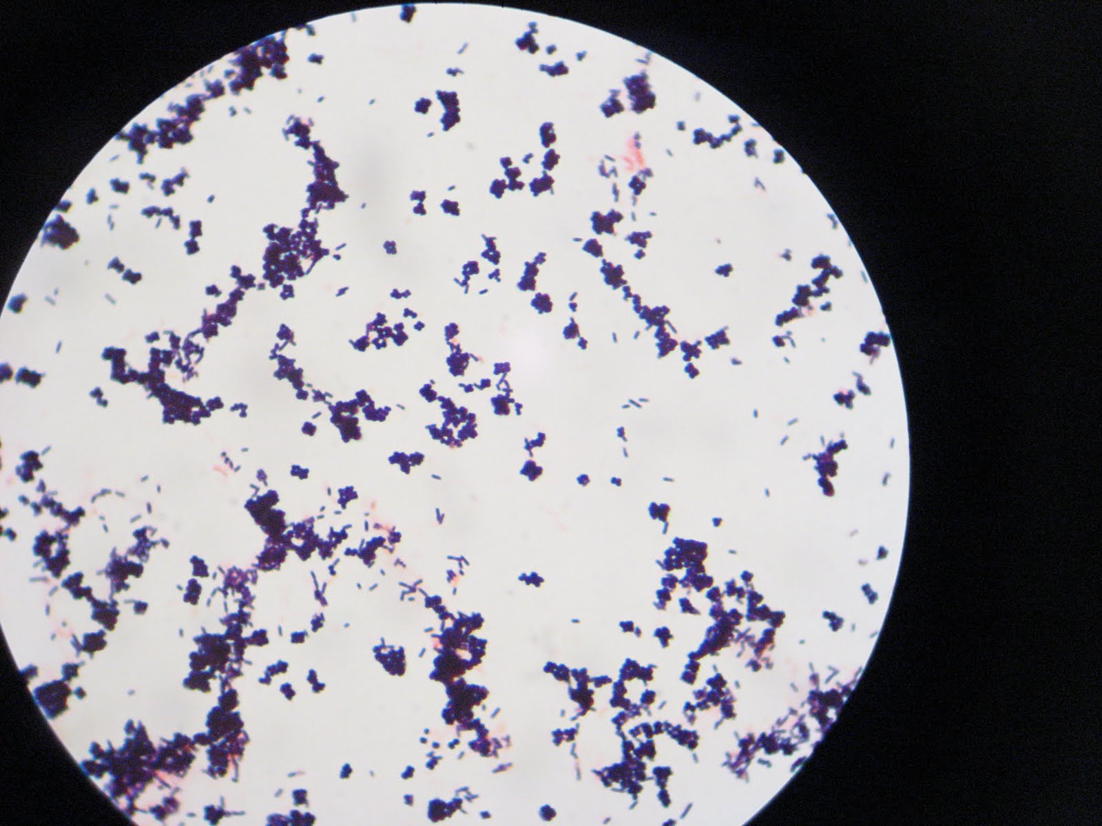 DVC Microbiology 146 Fall 11 (Gard) Lab 1 Gram Stained Mixed Bacteria