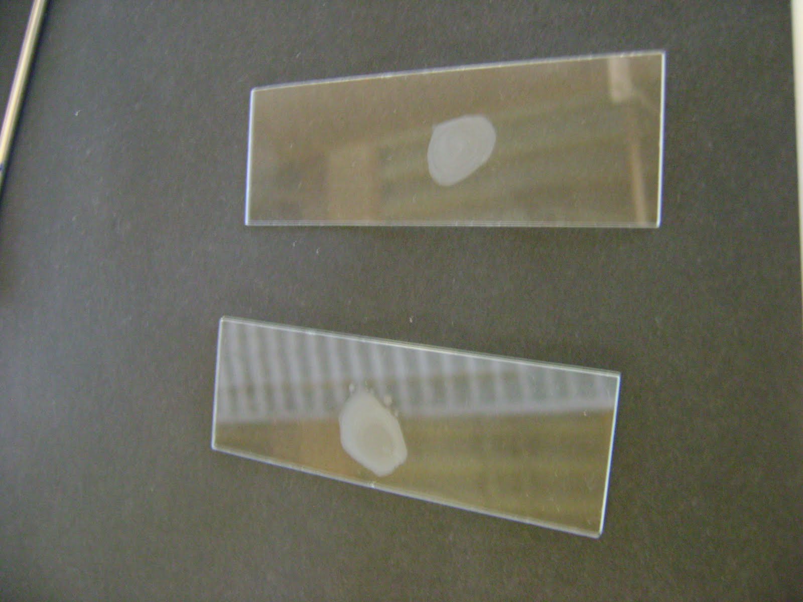 MedicALI Microbiology Preparing and Staining a Bacterial Smear