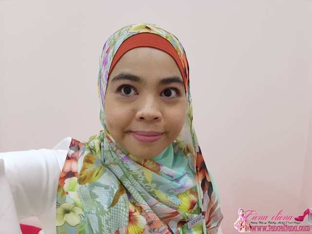 PENGALAMAN  RAWATAN MICRODERMABRASION DAN WHITENING PEEL DI KLINIK DR. BAZILAH