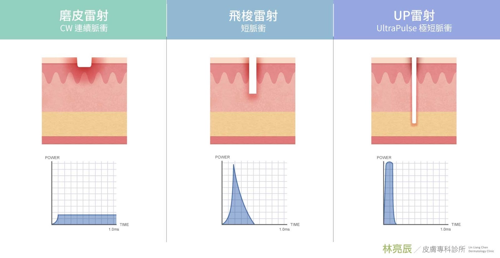 UP雷射恢復期價錢費用磨皮雷射飛梭雷射比較差別術後保養痘痘皮膚科青春痘成因青春痘藥膏乳液新竹皮膚科推薦敏感痘痘肌保養品林亮辰醫師林亮辰皮膚科診所