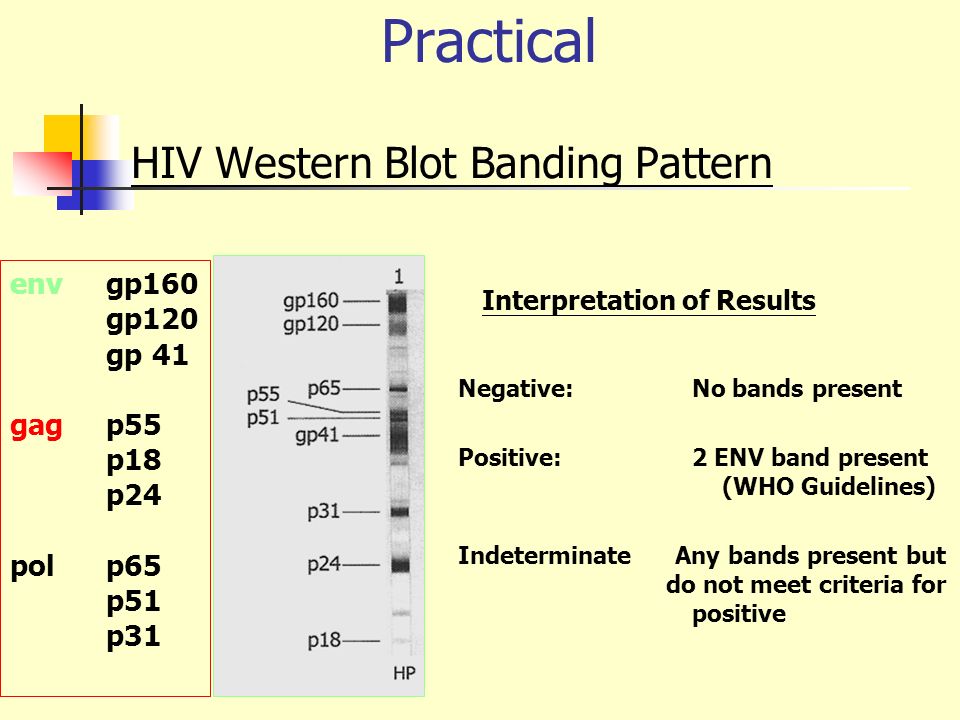 Jayhawk Infectious Diseases Approaching HIV cases