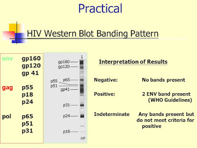 hiv bands