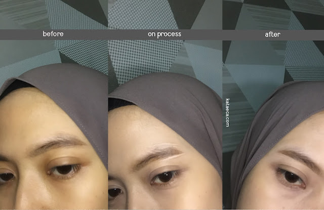 before after penggunaan concealer