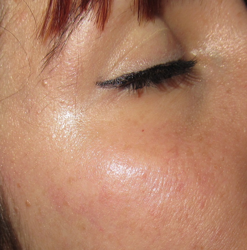 * Freak Muffin * L'Oreal Melon Dollar Baby