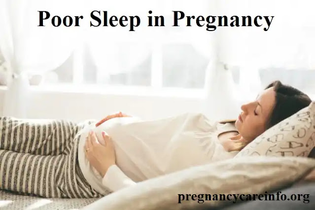 Poor Sleep in Pregnancy