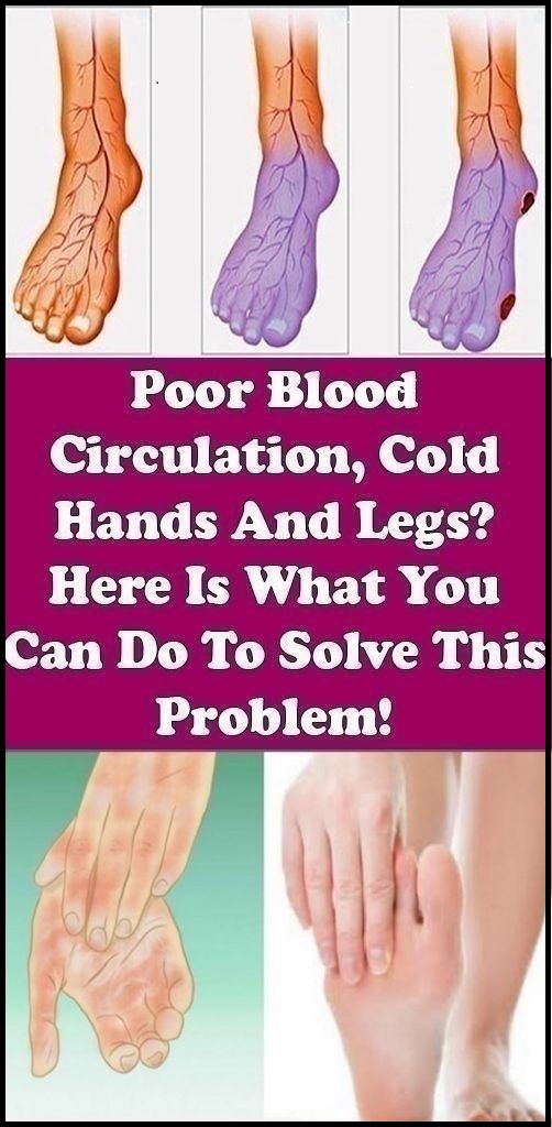 Poor Blood Circulation, Cold Hands And Legs? Here Is What You Can Do To
