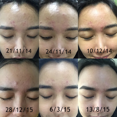 dr ko skin specialist near me