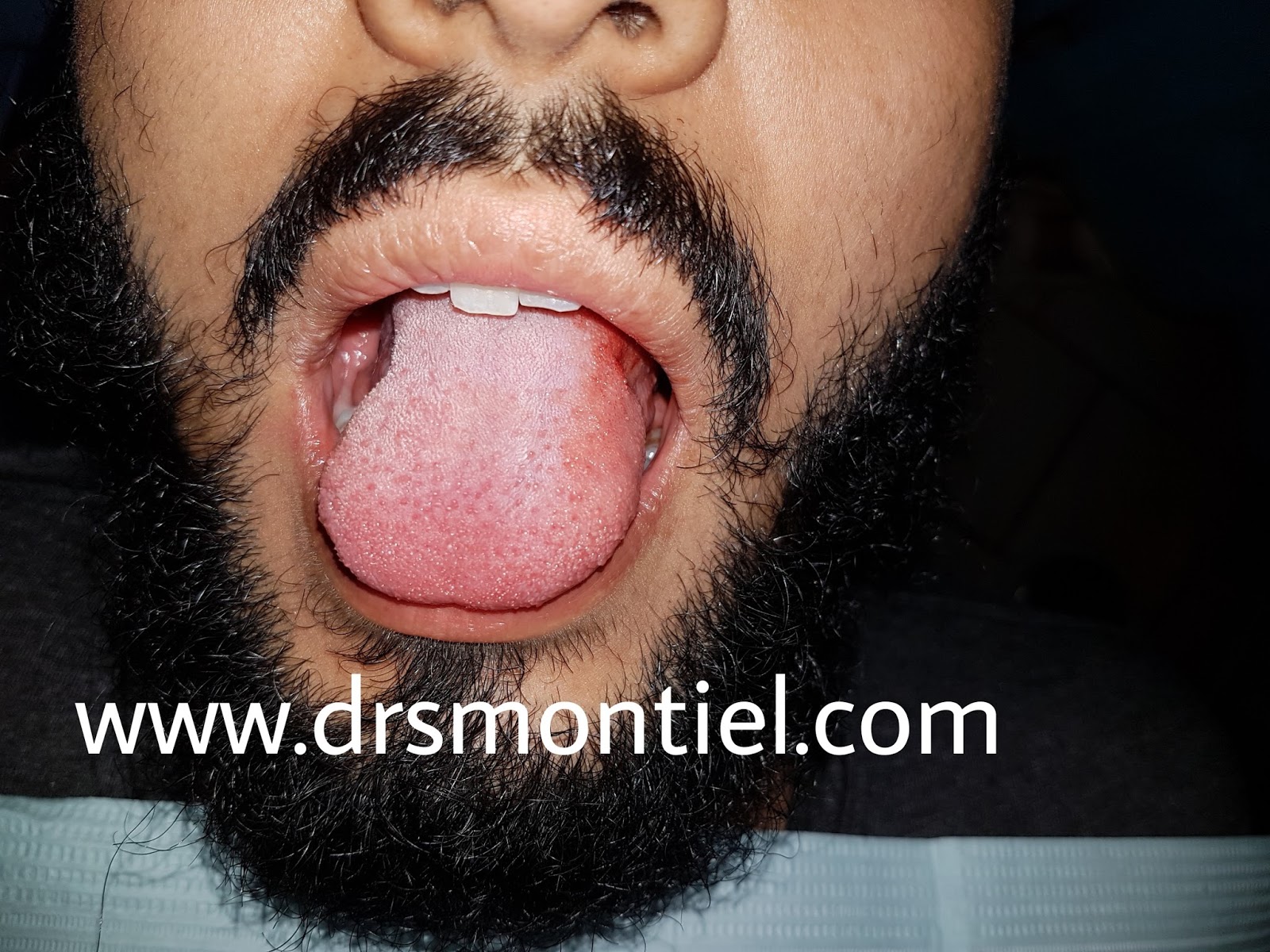 Cirujano Oral, Estética y Armonización