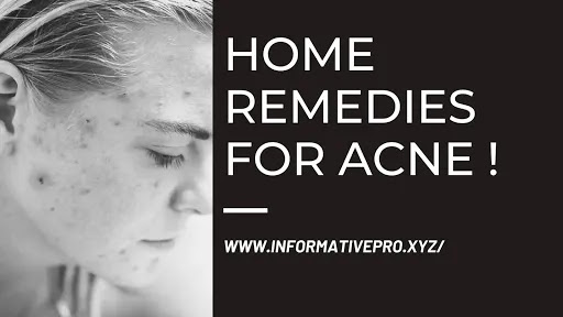 home remedies for acne fro www.informativepro.xyz/
