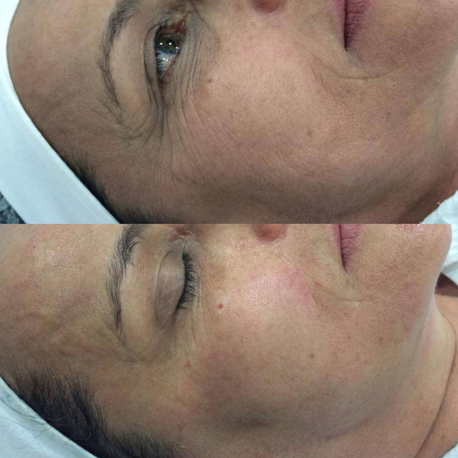 RENT A LASER: Curso de Reabilitação Funcional Estética com Laser