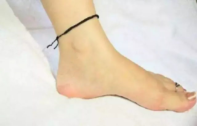 These things of the kitchen can make the torn ankles soft Funny Jokes These things of the kitchen can make the torn ankles soft Funny Jokes