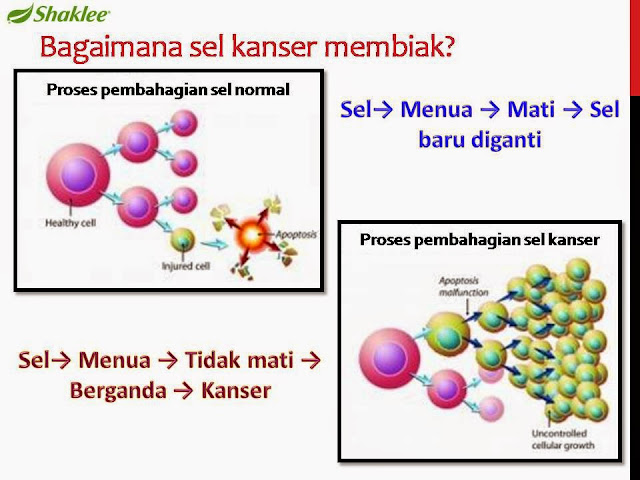 kanser tumor otak sel kanser