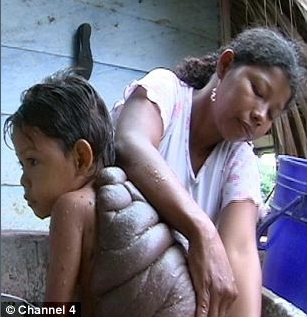 Το παιδί χελώνα The turtle child