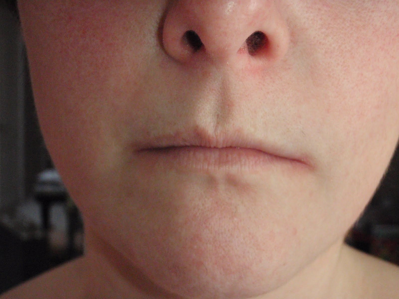 Princess Lupus The Things I Hide About my "Invisible" Disease Lupus