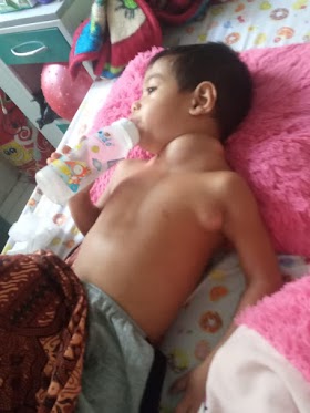 Sakit kelenjar getah bening, Al Fajri Anak yatim 3,5 tahun butuh uluran tangan