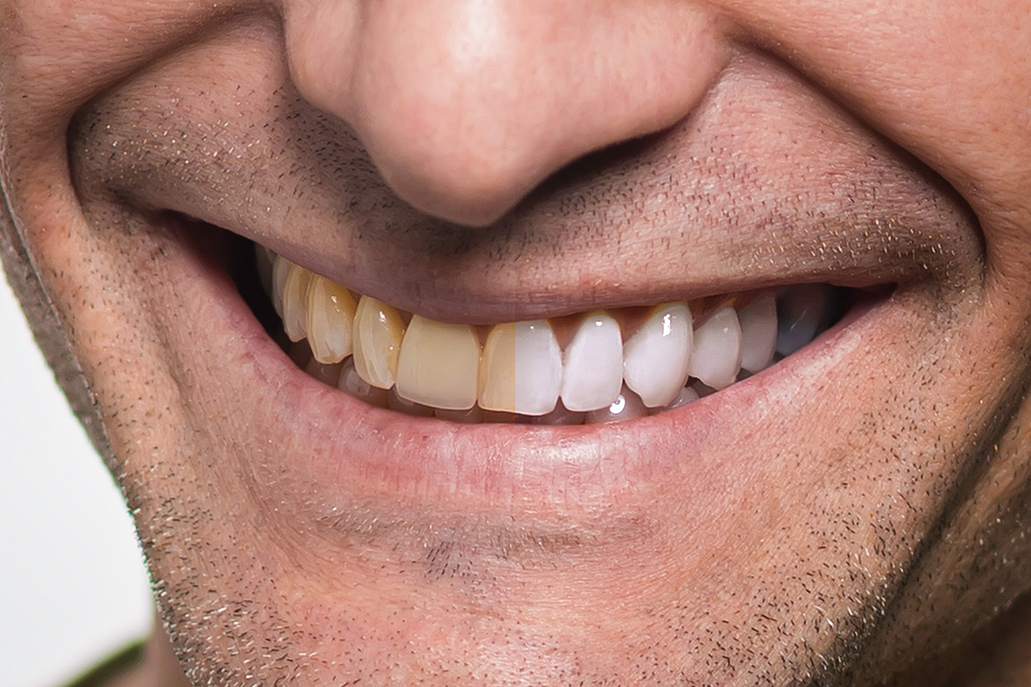 Teeth Whitening in Quick & Easy Retouching School