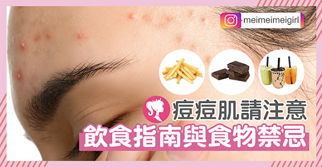 容易長痘痘，痘痘肌抗痘不能吃什麼？