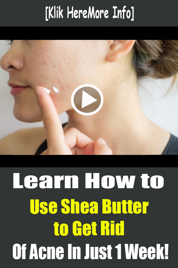 Learn How to Use Shea Butter to Get Rid of Acne grendbeauty