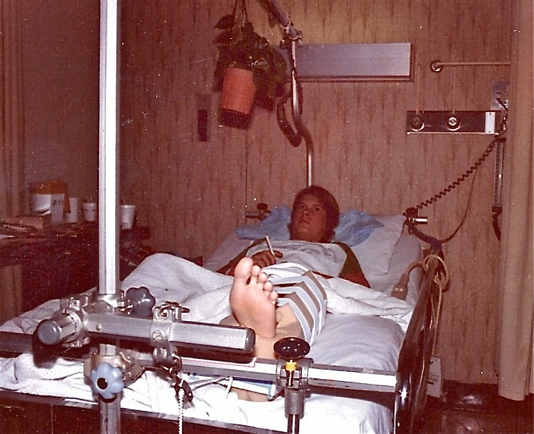 in traction broken back, Henrico Doctors Hospital, Richmond, VA, May, 1982