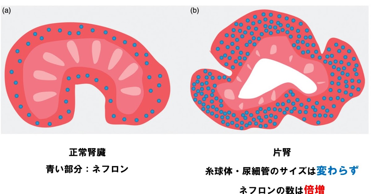 僕たちのキセキ 片腎患者さんの診療を考えてみる とくにraa系阻害薬使用に関して