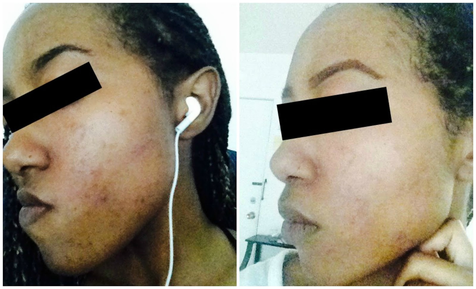 Makeup Artist's Choice Before/After Pics and Testimonials