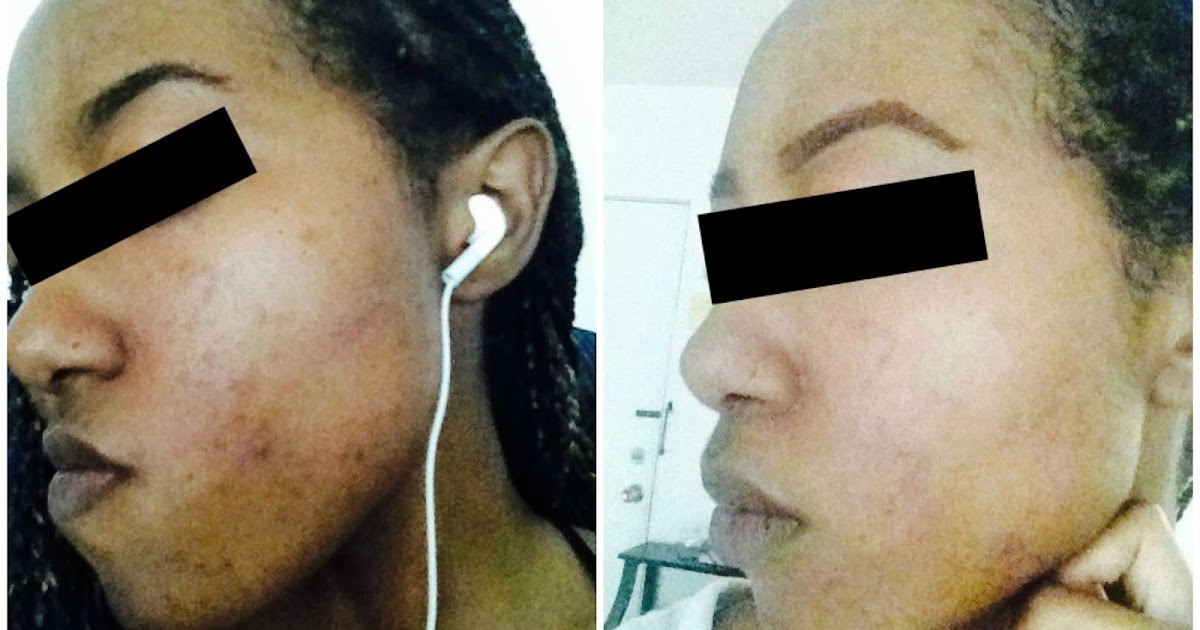 Makeup Artist's Choice Before/After Pics and Testimonials