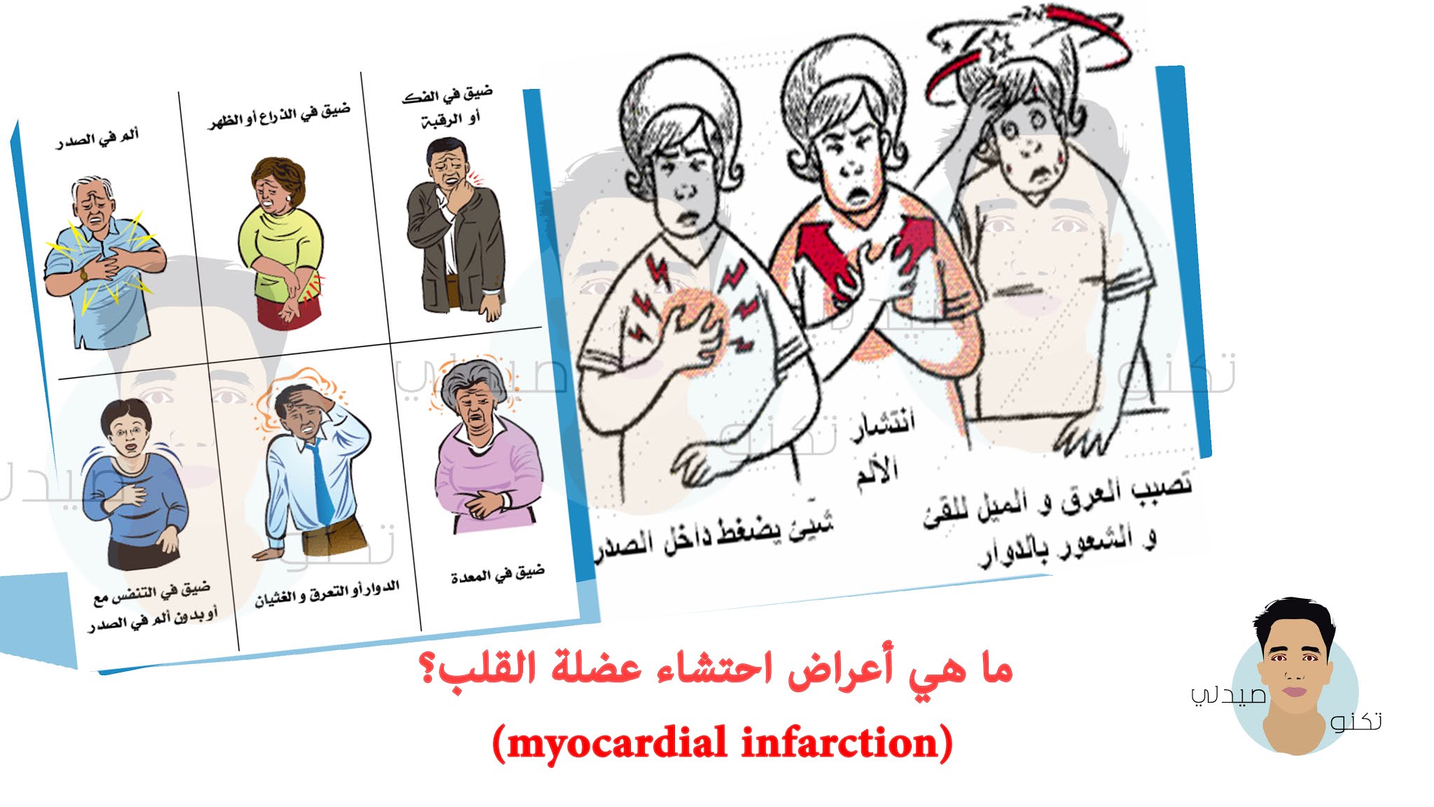 الحد من احتشاء عضله القلب عبر الجراحة الحد من احتشاء عضله القلب عبر الجراحة