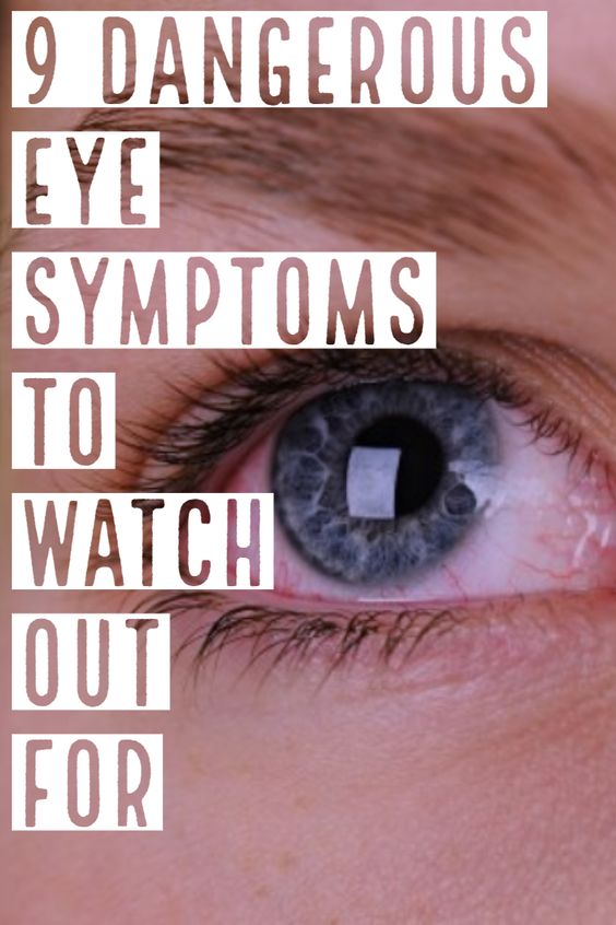 9 Serious Eye Symptoms to Watch Out For Wellness True