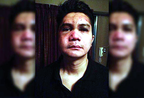 “THIS COMING WEEK VHONG NAVARRO WILL BE ARRESTED!” -- TONY CALVENTO “THIS COMING WEEK VHONG NAVARRO WILL BE ARRESTED!” -- TONY CALVENTO