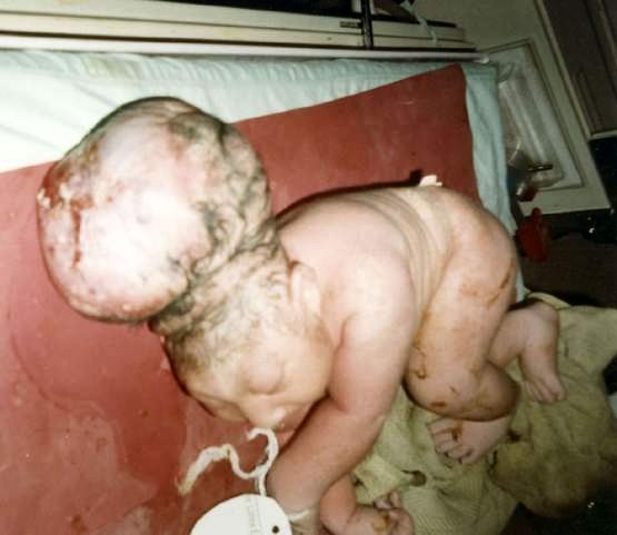 deformed-children-uranium-kills-kids-girls-boys-deform.jpg