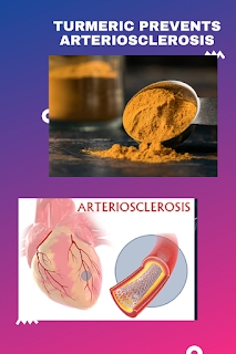 turmeric prevents arteriosclerosis