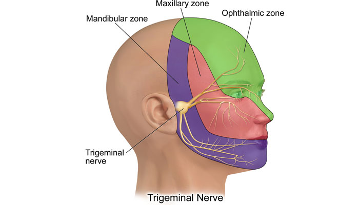 Inflamacion del nervio trigemino