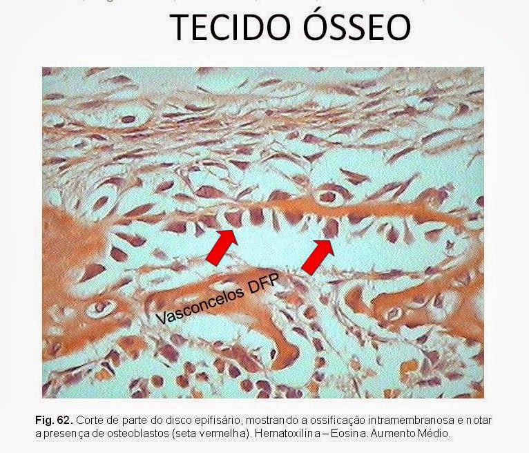 Bio Lógica : Tecido Ósseo