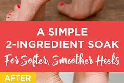 A Simple 2-Ingredients Soak For Softer, Smoother Heels
