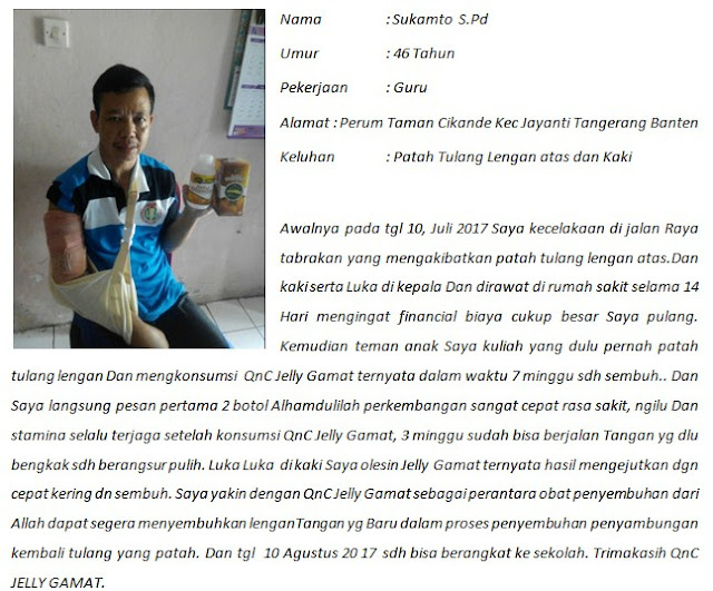Obat Patah Tulang Tangan Lengan