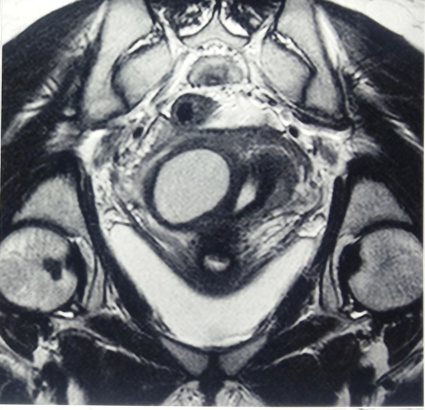 Journal of Postgraduate Gynecology & Obstetrics Robert’s Uterus
