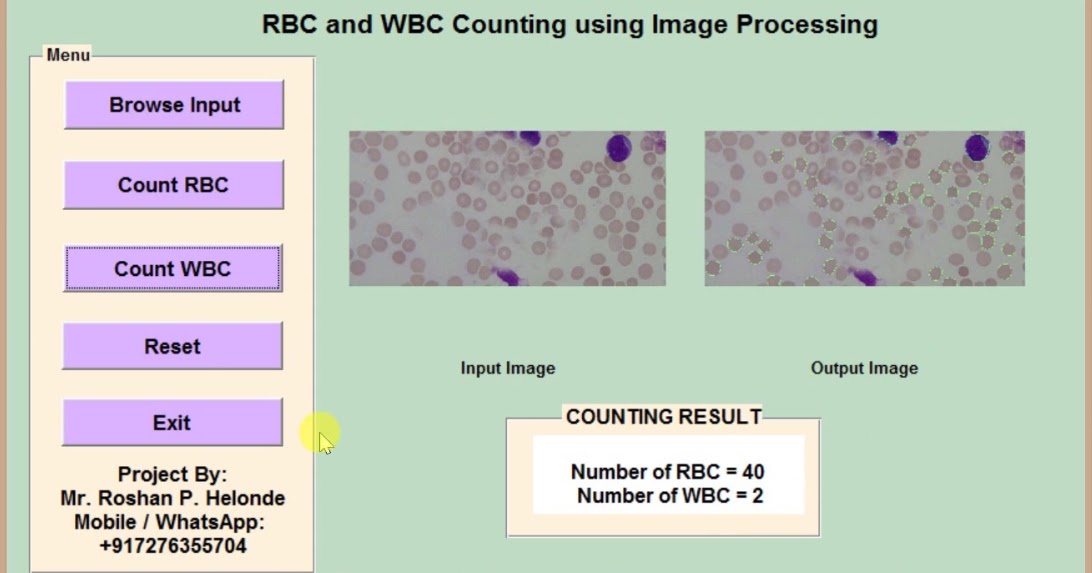RBC and WBC Detection and Counting in Blood Cells using Image ...