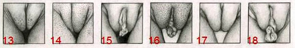 Types Of Pussy Pics 105