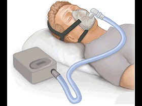 how to treat obesity hypoventilation syndrome
