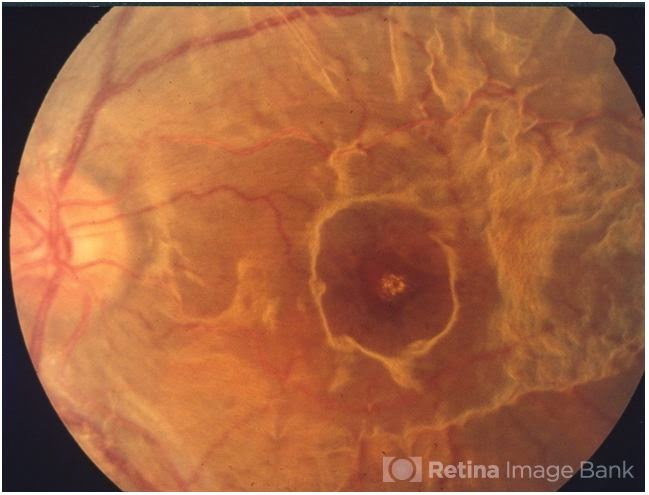 Ophthalmology OSCE