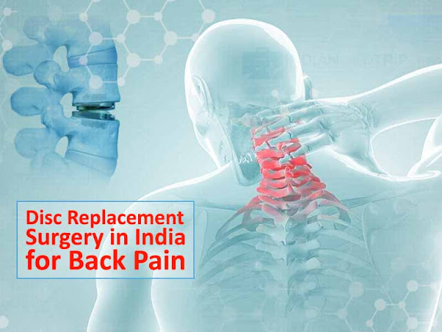 Disc Replacement Surgery in India